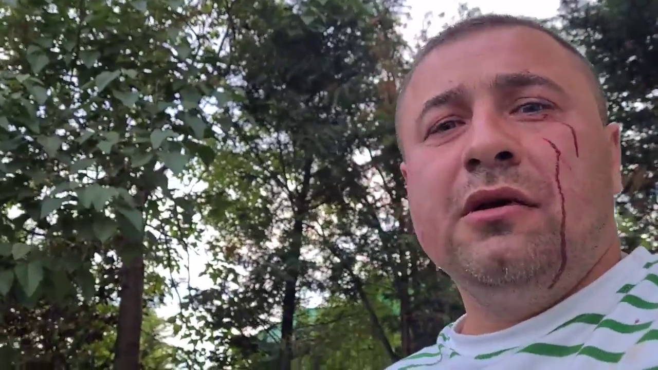 VIDEO Activistul pedepsit în stil mafiot, înspăimântat după ce agresorii au fost lăsați liberi. Se teme de o răzbunare