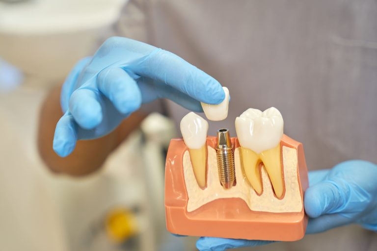 Ceimplicatratamentulcudintificsi (1)